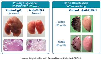 Image of Anti-CHi3L1 monoclonal immunotherapy